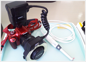 口腔内カメラ